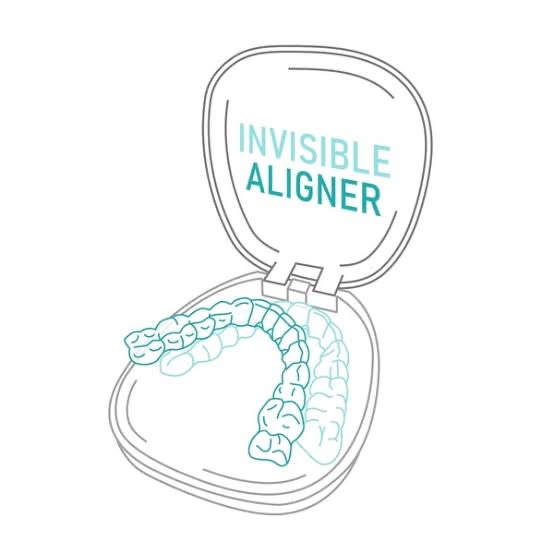 ALIGNERS & BRACES