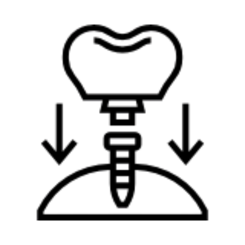 DENTAL IMPLANTS