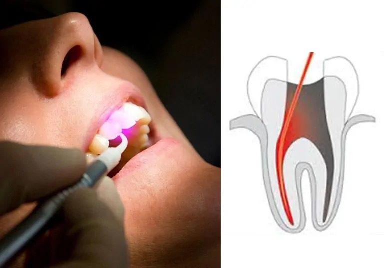 DENTAL CLINIC IN SAHAKARNAGAR