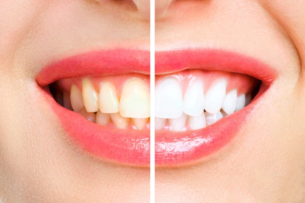 DENTIST IN KOTHANUR
